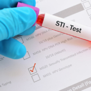 A blood sample labeled for STI testing