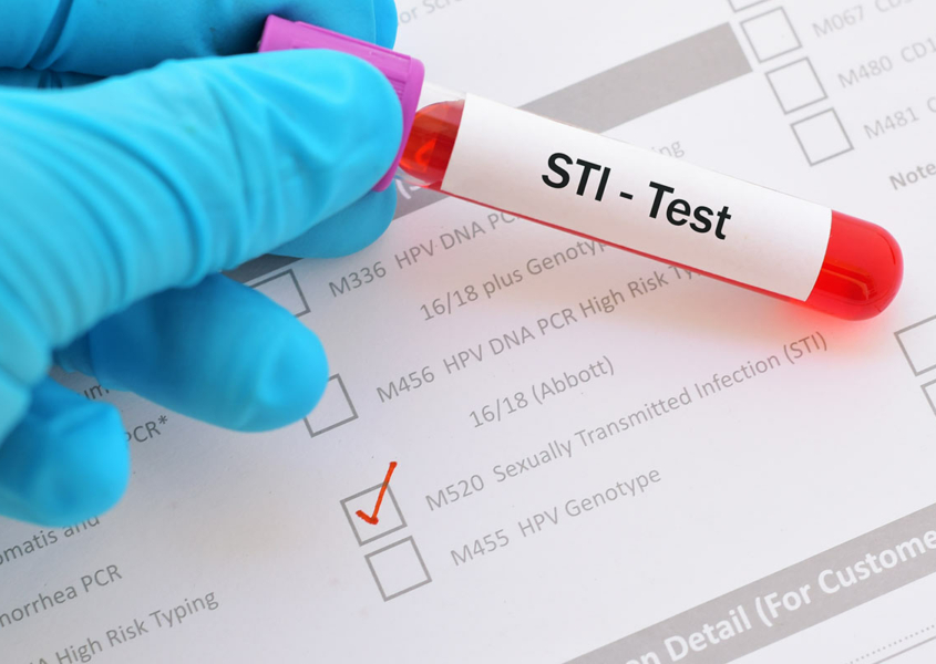 A blood sample labeled for STI testing