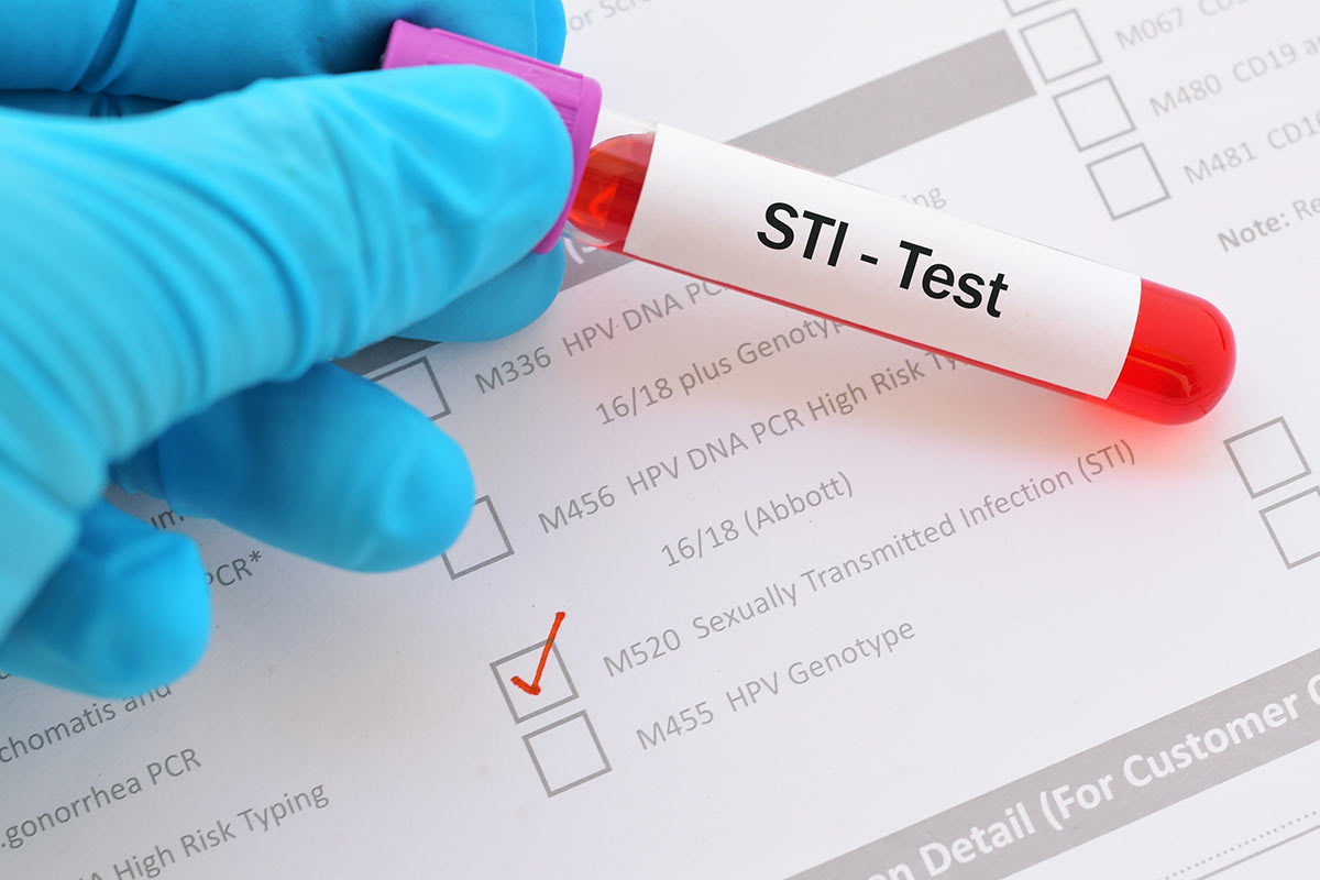 Why STI Testing Should Be Part of Your Self-Care Routine